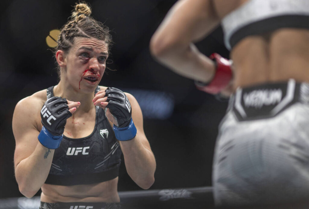 Mackenzie Dern came out looking worse for wear at UFC 298.